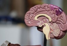 Dementia expected to double in Gippsland Anatomical human brain model