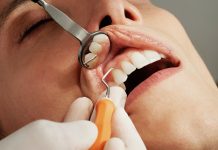 More investment needed in decaying public dental