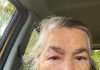 The painful reality of shingles